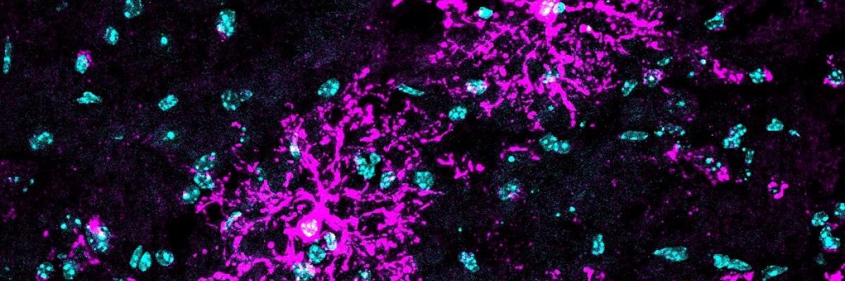 Cellule GPR17-positive